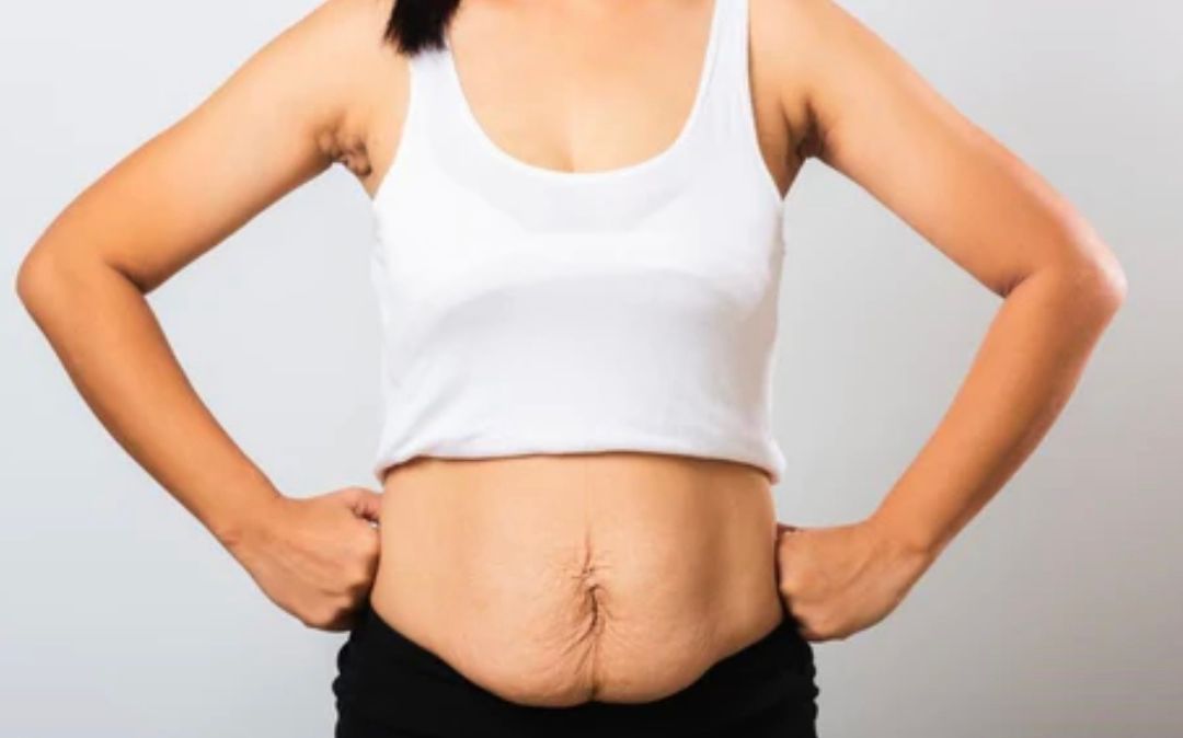 Strijat – A mund të hiqen?